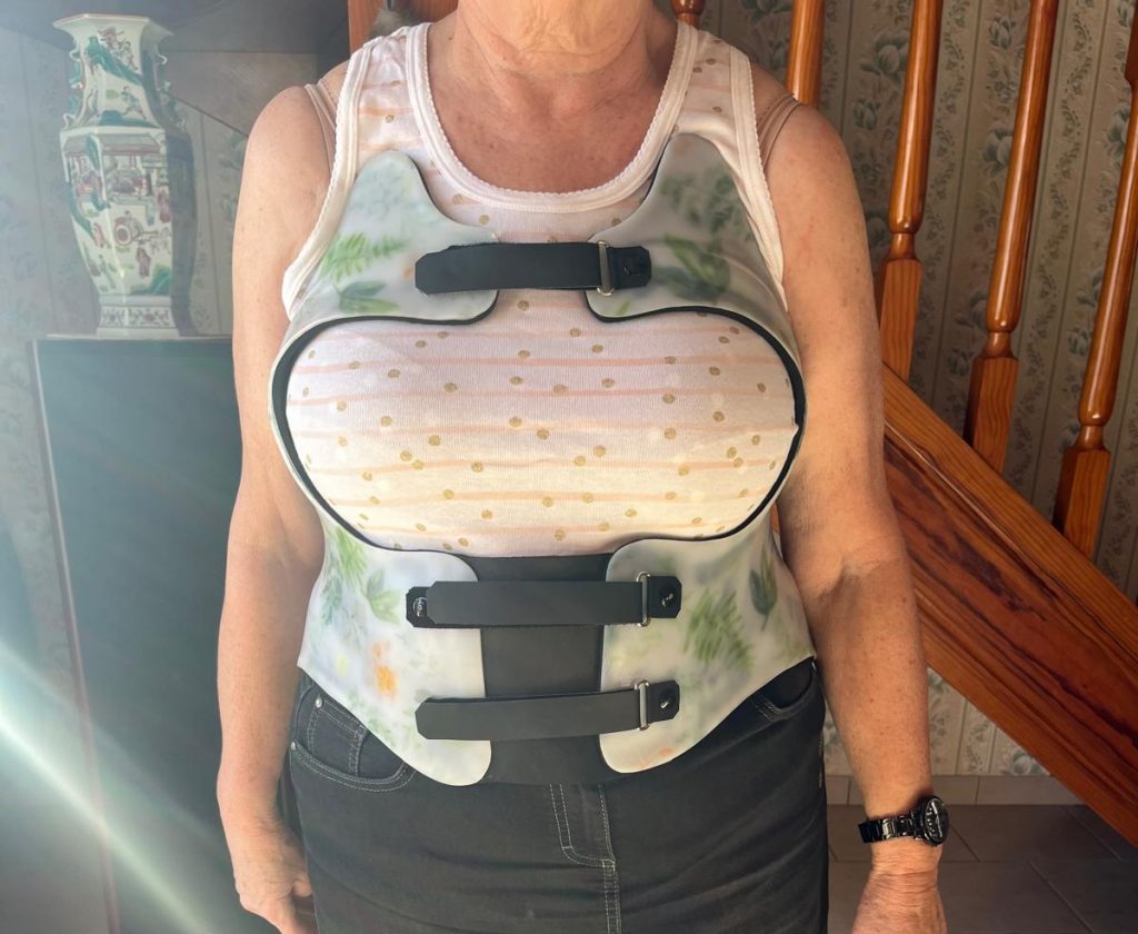 Les corsets orthopédiques - Appareillages Sud Prothèse